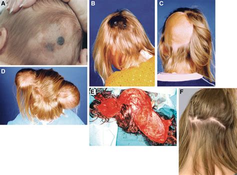 A, Clinical appearance of the patient with the congenital ...