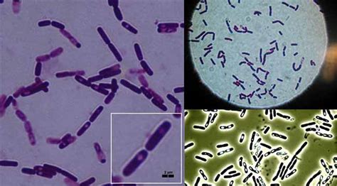 Clinical Biochemistry By Dr P K Prabhakar Bacillus Cereus An Overview