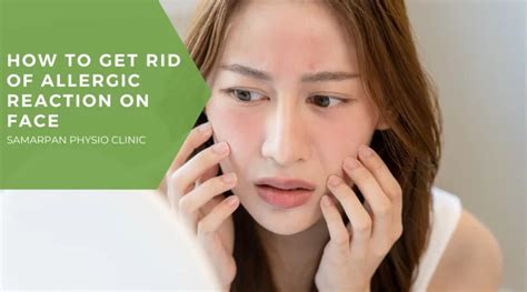 How To Get Rid Of Allergic Reaction On Face Samarpan Physio