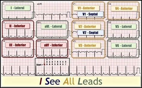 12 Lead Interpretation Chart Chartdevelopment