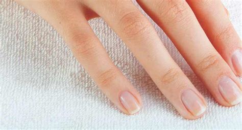 Learn more from webmd about how to get plenty of vitamin d, and how to treat a vitamin d deficiency. What Vitamin Deficiency Causes Nails to Peel? by Duskyskin.com