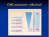 Photos of Cml Cancer Treatment