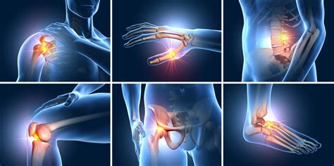 Joint Fusion Surgery Orthopaedic Specialist Near Me