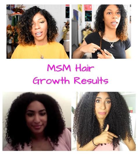 Contains more vitamin c than in 10 oranges.^ emerge and see today! MSM Hair Growth Before and After Pictures | Msm hair ...