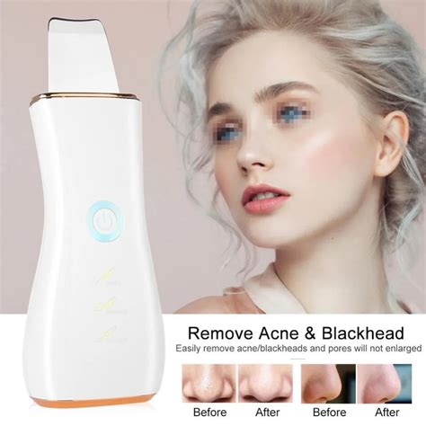 ultrasonic ion skin scrubber deep cleansing face skin cleaner blackhead acne removal face