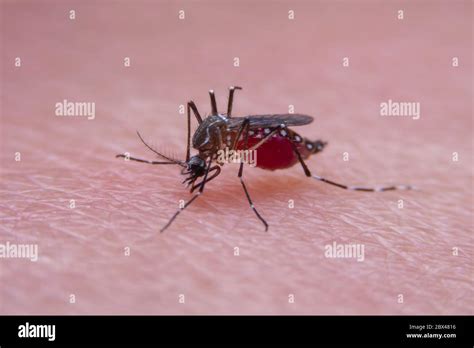 Bug Bite Skin Hi Res Stock Photography And Images Alamy