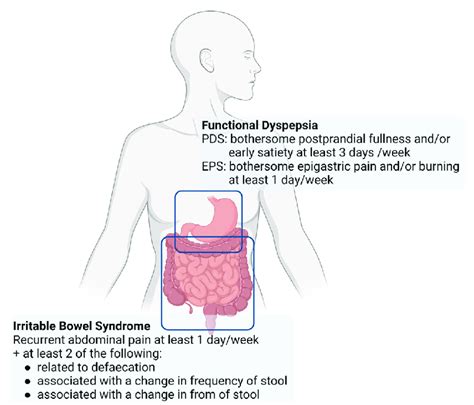 Rome Iv Criteria Of Functional Dyspepsia And Irritable Bowel Syndrome