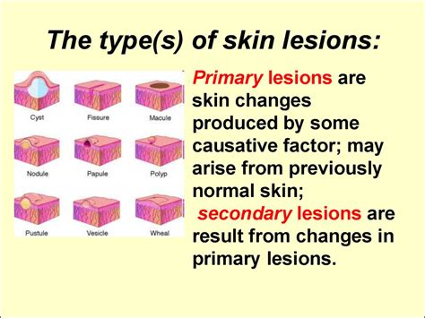 Types Of Skin Lesions Benign Skin Lesions Plastic Surgery Key