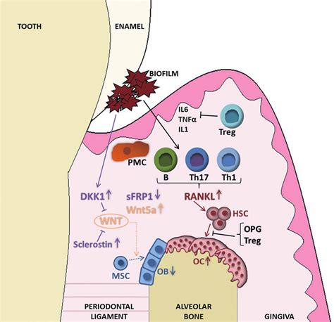 Pathomechanism Of Periodontitis Induced Bone Loss The Biofilm Download Scientific Diagram