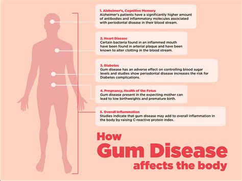 How Gum Disease Affects the Body | Visual.ly