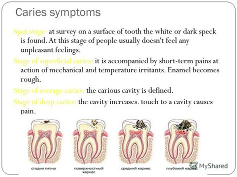 Early Childhood Caries Symptoms White Spot Lesions Tooth Decay Pain