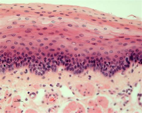 Stratified Squamous Epithelial Histology Slides Pinterest