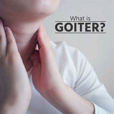 Sushruta What Is Goiter What Is Goiter Disease What Is Goiter
