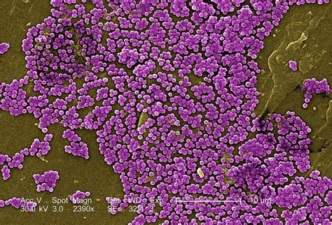 Antibiotic Resistance Of Mrsa Microbewiki