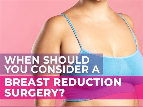 when should you consider a breast reduction surgery