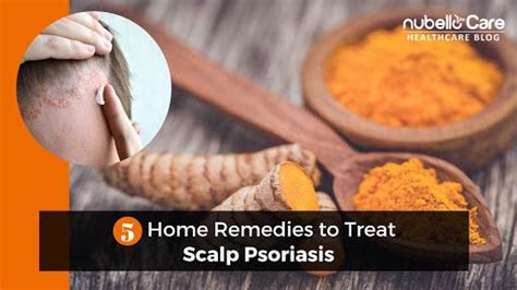 Treat Scalp Psoriasis One Of The Common Skin Condition At Home With