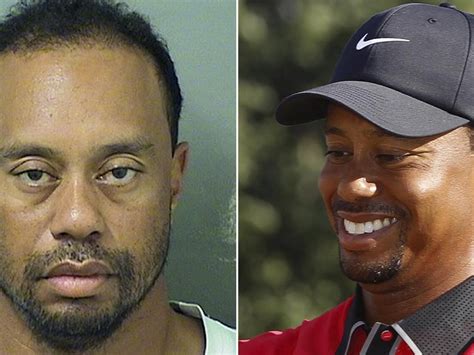Tiger Woods Fue Sometido A Una Larga Cirugía Tras Su Accidente