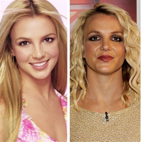 Britney Spears Före Och Efter Kosmetisk Kirurgi Verge Campus Peaceful Place