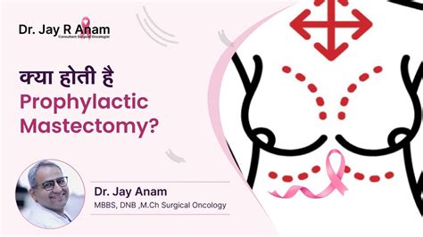 What Is Prophylactic Mastectomy Prophylactic Mastectomy क्या होता है Dr Jay R Anam Youtube