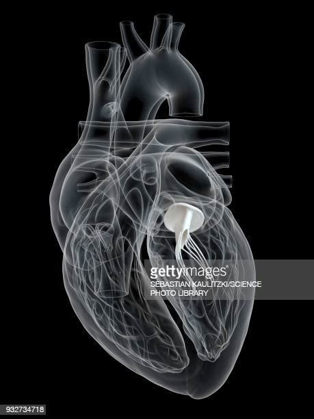 Mitral Valve Photos And Premium High Res Pictures Getty Images