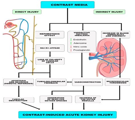 Proposed Mechanism Of Contrast Induced Acute Kidney Injury Download