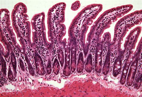 A correct histopathological diagnosis is crucial for the choice of subsequent treatment. Cancer Histology Core