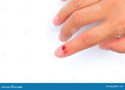 Injured Finger Stock Image Image Of Injured Bleed Finger 49223835
