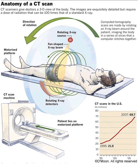 3d Ct Scan Machine