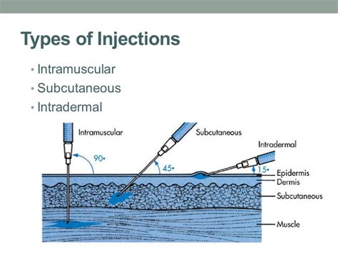 Image Result For Intradermal Subcutaneous Injection Dermis Epidermis