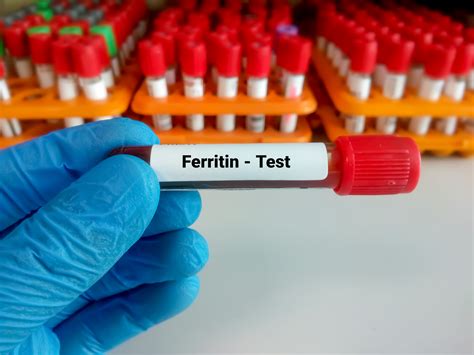 Ferritin Test Everything You Need To Know Apollo Hospital Blog