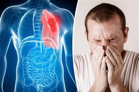 Others do have symptoms but, because those symptoms are so vague Lung cancer symptoms and prevention: Seven signs of a ...