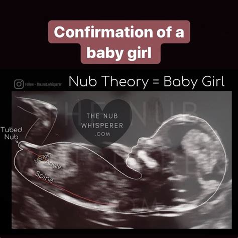 It S A Girl First Ultrasound Nub Theory Gender Prediction