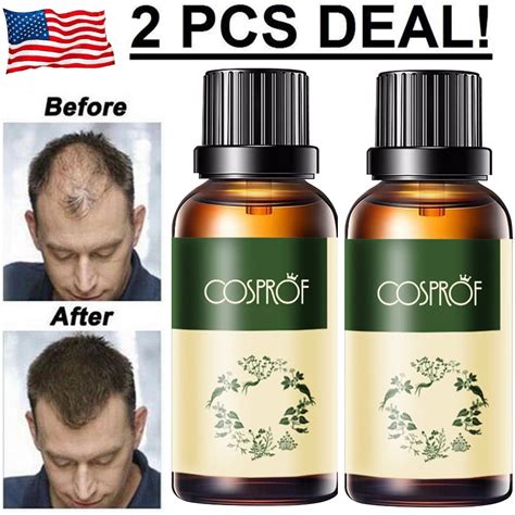 Pack Hair Growth Products For Men Women Natural Oil Serum Loss Grow