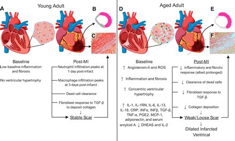 cardiac tissue remodeling in healthy aging the road to pathology american journal of