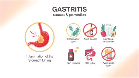 7 Day Meal Plan For Gastritis Balancing Nutrition And Gastritis