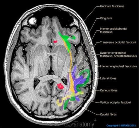 Brain - White matter : Association fibres of telencephalon, Superior