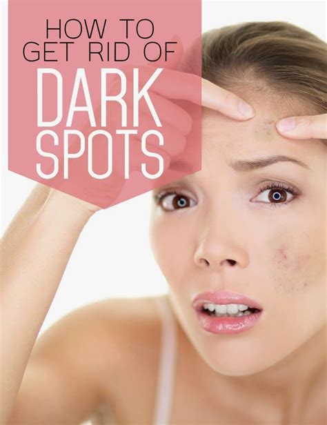 How To Get Rid Of Dark Spots Pin Remedies Dark Spots Home Remedies