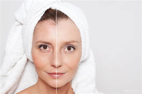 Skin Care Treatment For Your 30s Oneill Plastic Surgery