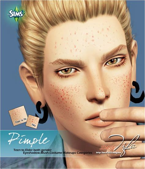 Pimple Sims The Sims Sims 4