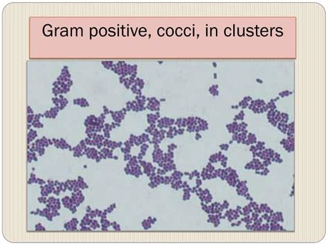 Gram Positive Cocci Blood Culture Firsthandwebdesign