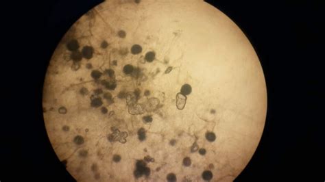 Jamur Tempe Dilihat Dari Mikroskop Homecare24