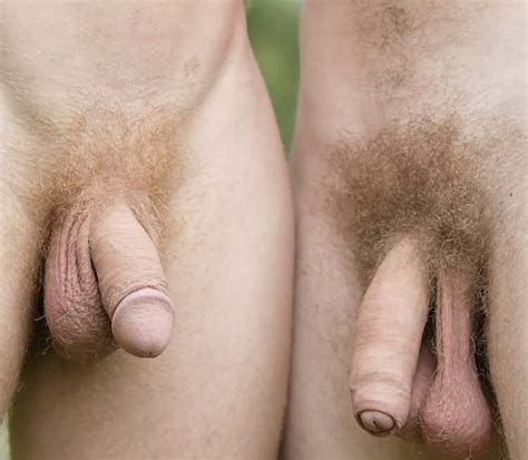 Circumcised Vs Uncircumcised Vagina Diagram Mega Porn Pics