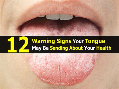 12 Warning Signs Your Tongue May Be Sending About Your Health