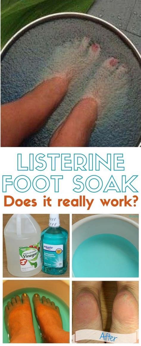 Does The Listerine Foot Soak Really Work Organizing Home Life