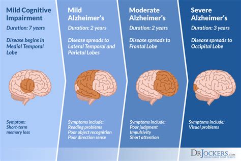 6 Ways A Ketogenic Diet Improves Brain Function - DrJockers.com