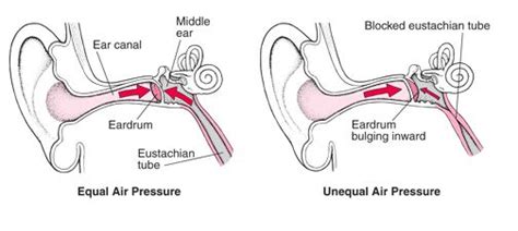 Ear Diagram Eustachian Tube Human Body Anatomy