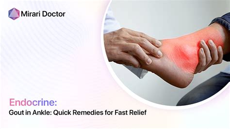 Gout In Ankle Quick Remedies For Fast Relief