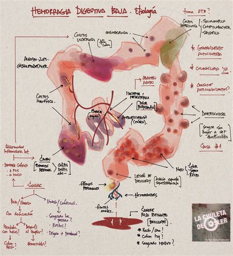 Gastroenterología Hemorragia digestiva baja etiología Medicine babe Medicine studies