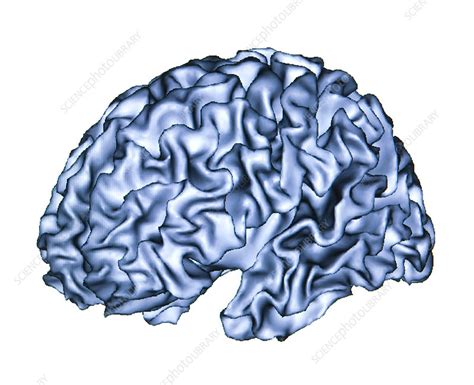 Advanced Mri Brain Scan Stock Image P3320516 Science Photo Library