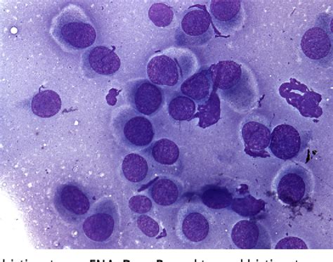 Figure 31 From Cytology Of Skin Neoplasms Semantic Scholar